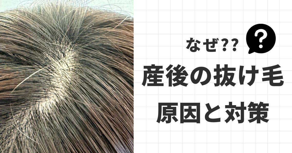 産後に抜け毛が増えるのはなぜ？いつからいつまで続く？自分でできる対策＆ケア