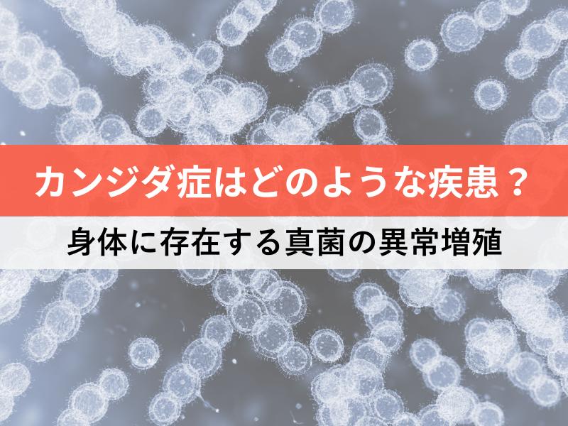 カンジダ症とはどのような疾患? 身体に存在する真菌の異常増殖