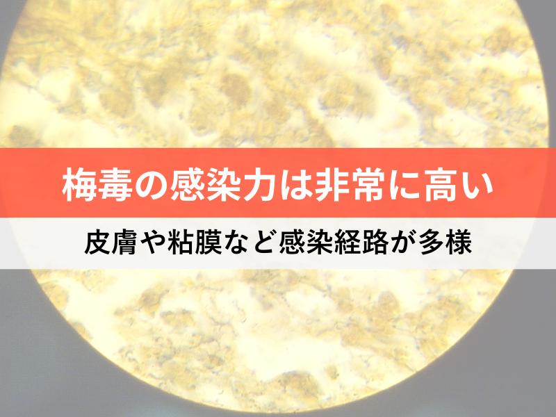 梅毒の感染力は非常に高い　皮膚や粘膜など感染経路が多様
