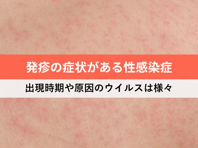 発疹の症状がある性感染症