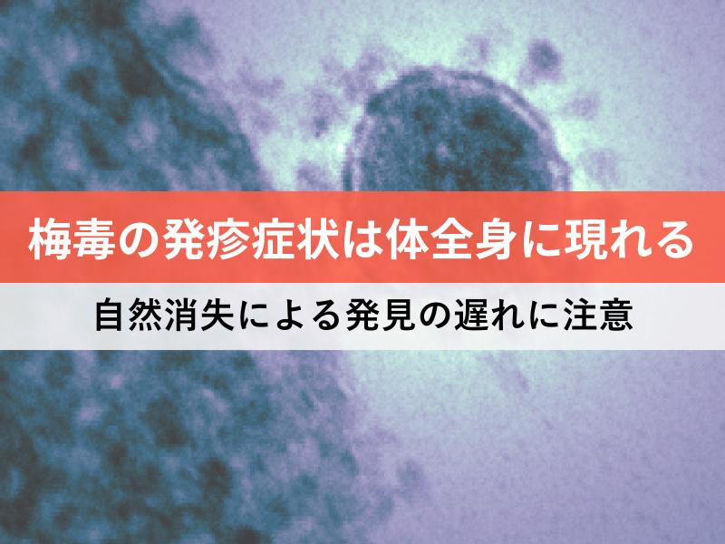 梅毒の発疹症状は体全身に現れる