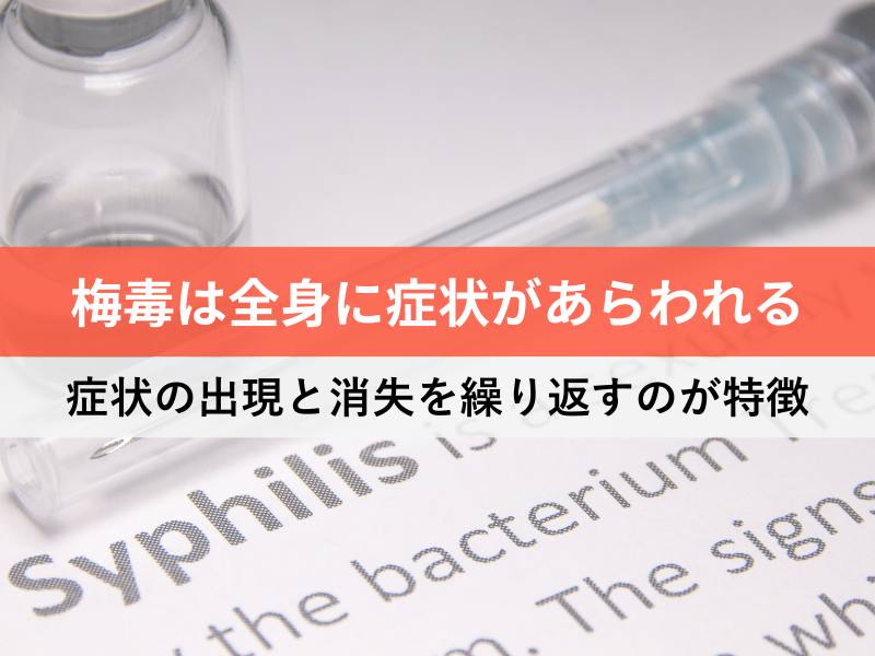 梅毒は全身に症状が現れる 症状の出現と消失を繰り返すのが特徴