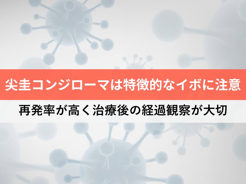尖圭コンジローマは特徴的なイボに注意 再発率が高く治療後の経過観察が大切