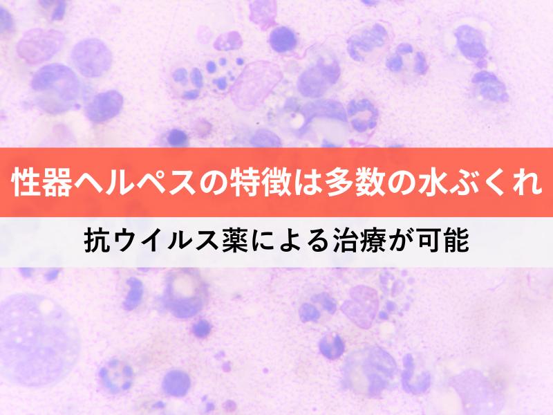 性器ヘルペスの特徴は多数の水ぶくれ