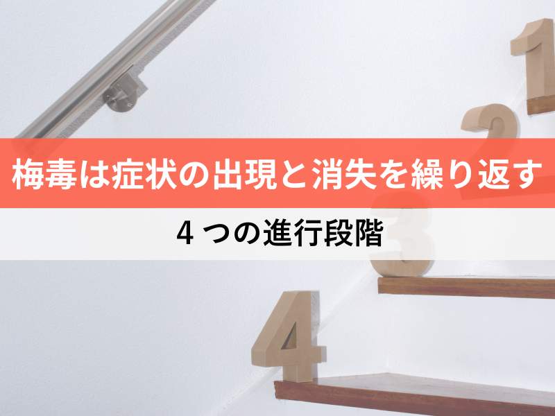 梅毒は症状の出現と消失を繰り返す 4つの進行段階