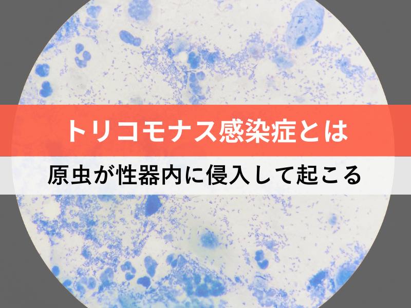 トリコモナス感染症とは 原虫が性器内に侵入して起こる