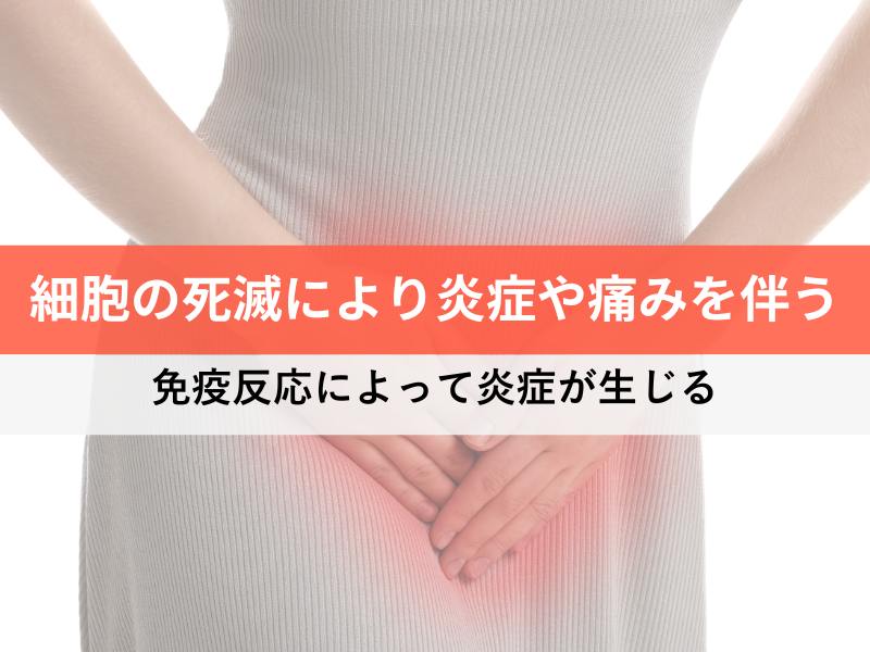 細胞の死滅により炎症や痛みを伴う 免疫反応によって炎症が生じる