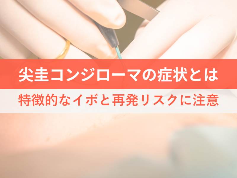 尖圭コンジローマの症状とは特徴的なイボと再発リスクに注意