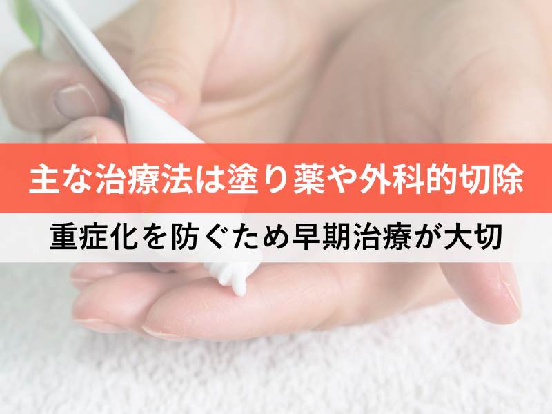 主な治療法は塗薬や外科的切除 重症化を防ぐため早期治療が大切